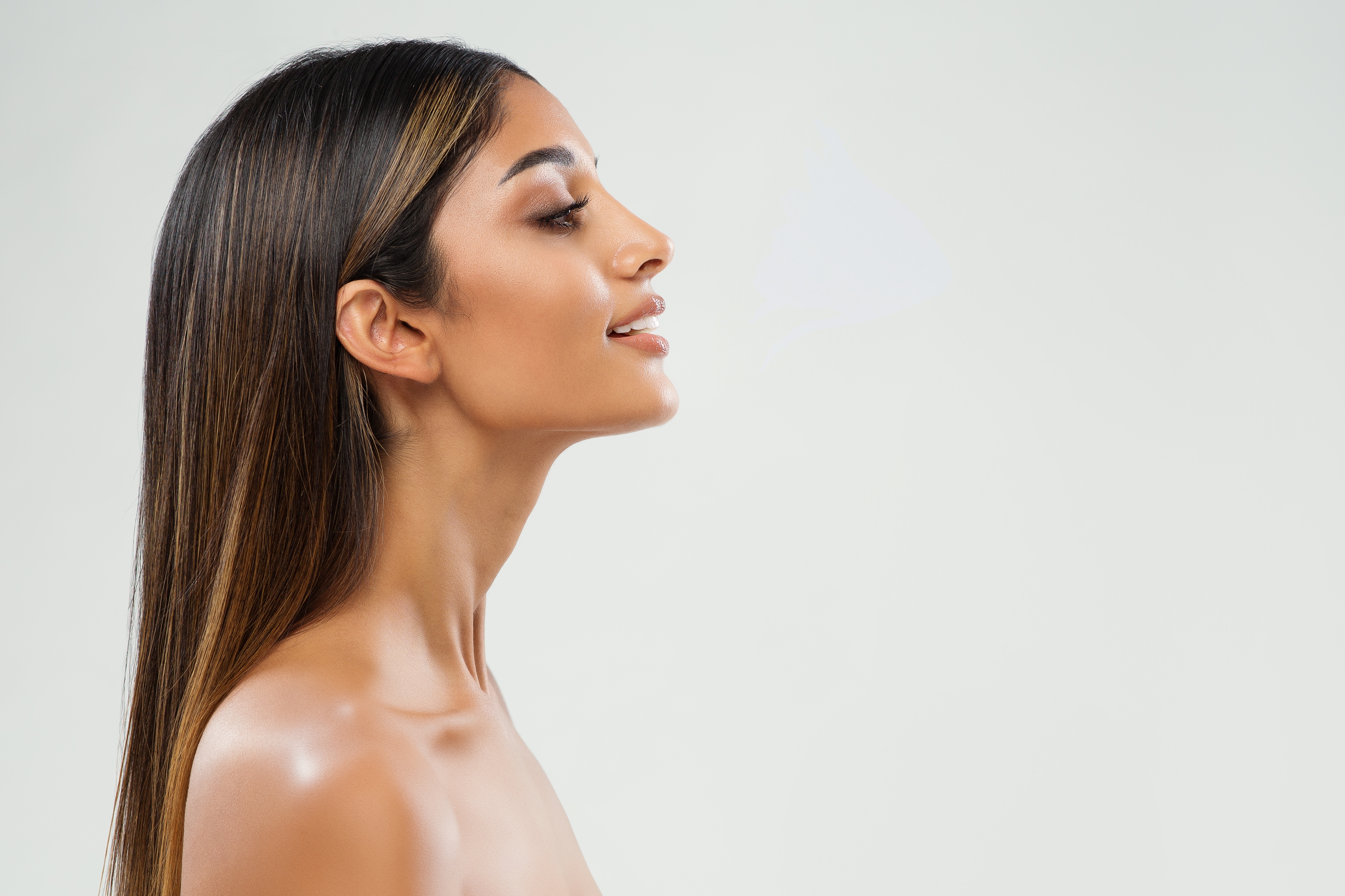 Rhinoplasty profile result